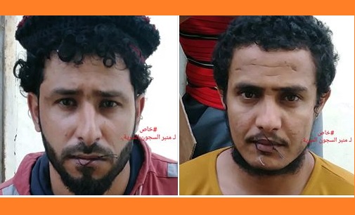 Leaked photos from UAE-run prison in Aden show detainees with sewed mouths