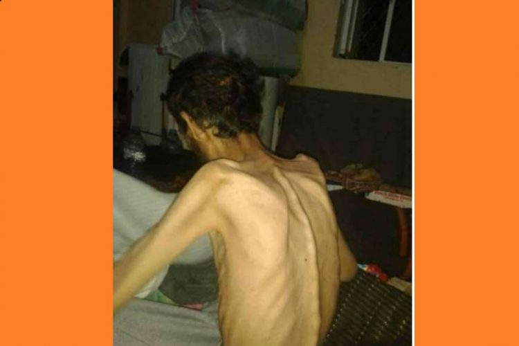 ناشطون يتداولون صورة صادمة لسجين من داخل سجون الحوثي في محافظة اب