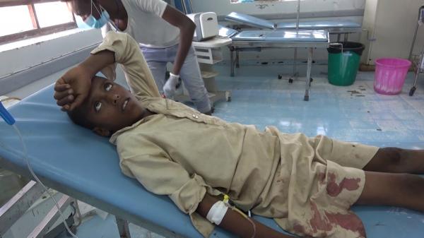 إصابة طفل برصاص مليشيا الحوثي في الحديدة